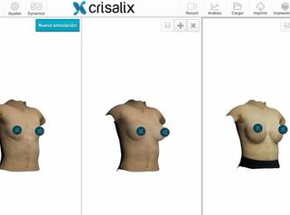 Crisalix - Simulación 