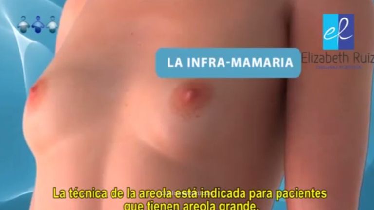 Consigue el pecho que siempre soñaste tener