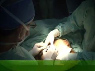 Acaba con los senos tuberosos
