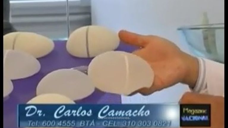 Carlos Camacho intervencion sobre implantes mamarios