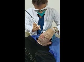 Peeling - Dr. Juan Carlos Herrera P.
