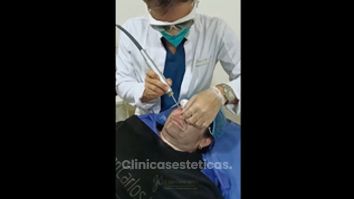 Peeling - Dr. Juan Carlos Herrera P.