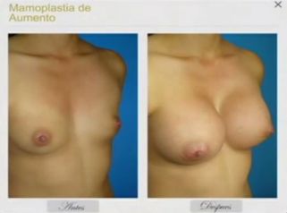 Mejoramos tu figura