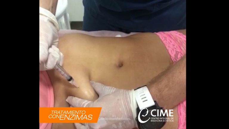 Tratamiento con Enzimas