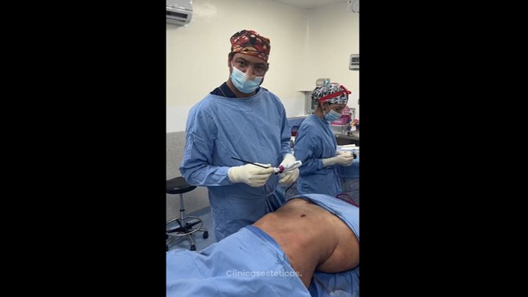 Lipo+ j plasma + vaser - Dr. Jarold Effer Taylor