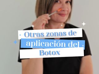 Otras zonas de aplicación del Botox - Dra. Niris Estrada