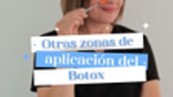 Otras zonas de aplicación del Botox - Dra. Niris Estrada