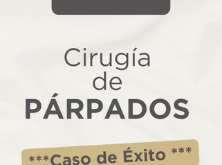 Blefaroplastia - Dra. Damaris Romero