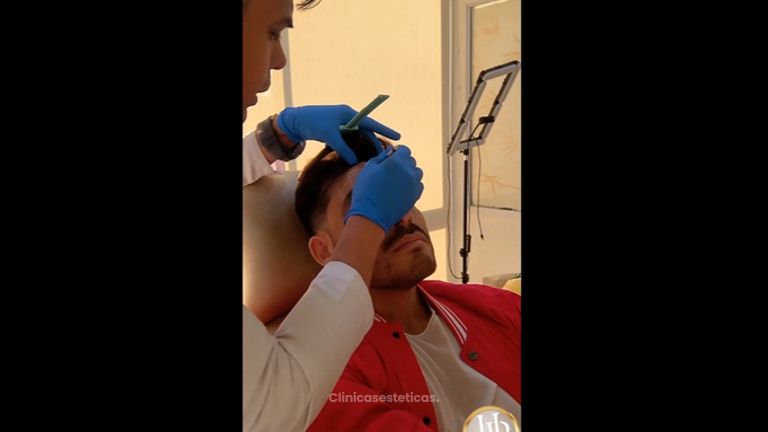 Toxina Botulínica - Dr. Henry Pallares