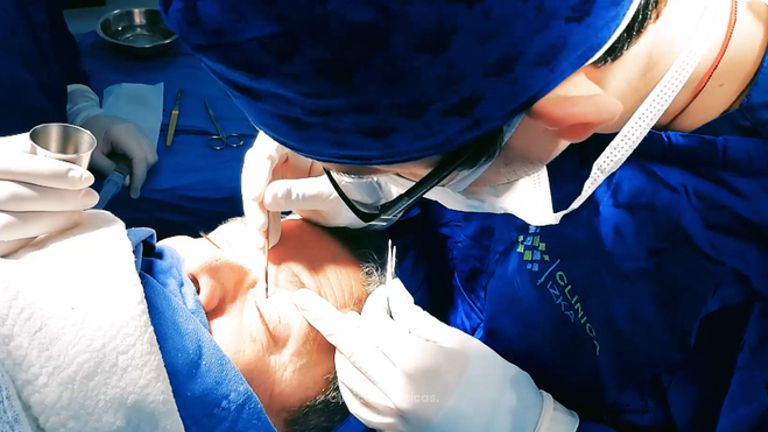Blefaroplastia - Dr. Johnatan L De Guevara