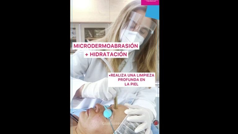 Microdermoabrasión - Doctora Alexandra Mora