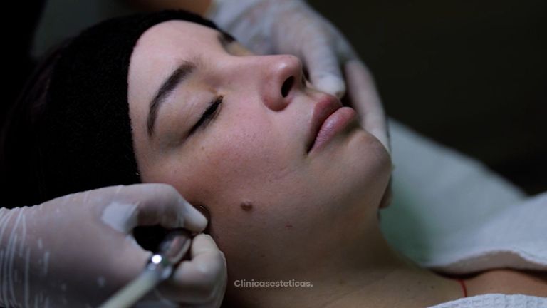 Rejuvenecimiento facial - Colorgy