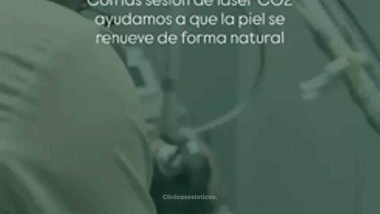 Lasér CO2 Fraccionado - Dr. Jeisson Gutiérrez Cañas