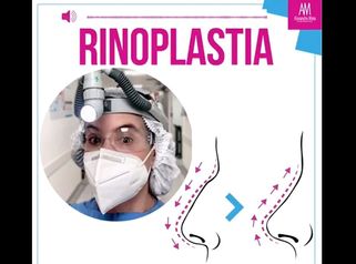 Rinoplastia - Doctora Alexandra Mora