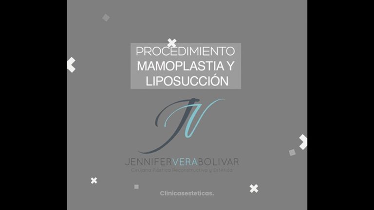 Mamoplastia + Liposucción - Dra. Jennifer Vera Bolívar