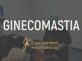Ginecomastia - Dr. Juan Carlos Herrera P.