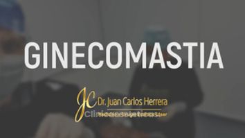 Ginecomastia - Dr. Juan Carlos Herrera P.