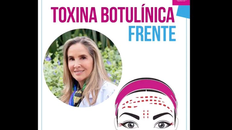 Toxina Botulinica - Doctora Alexandra Mora