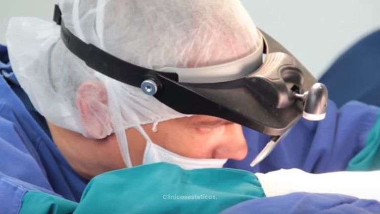 Rinoplastia Secundaria Abierta - Video de Cirugia Nariz en Bogotá paso a paso