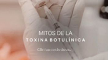 Mitos sobre la toxina botulínica - Luvent