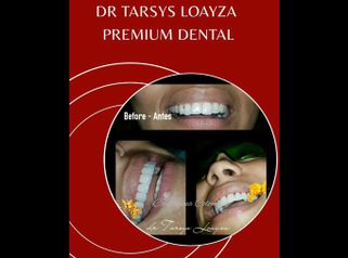 Sonrisa Perfecta Dental - Dra. Tarsys Loayza Roys
