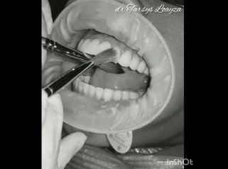 Sonrisa Perfecta Dental - Dra. Tarsys Loayza Roys