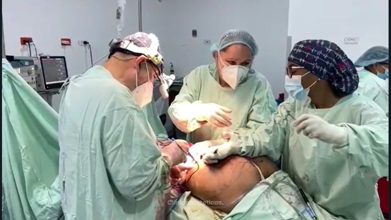 Gluteoplastia.