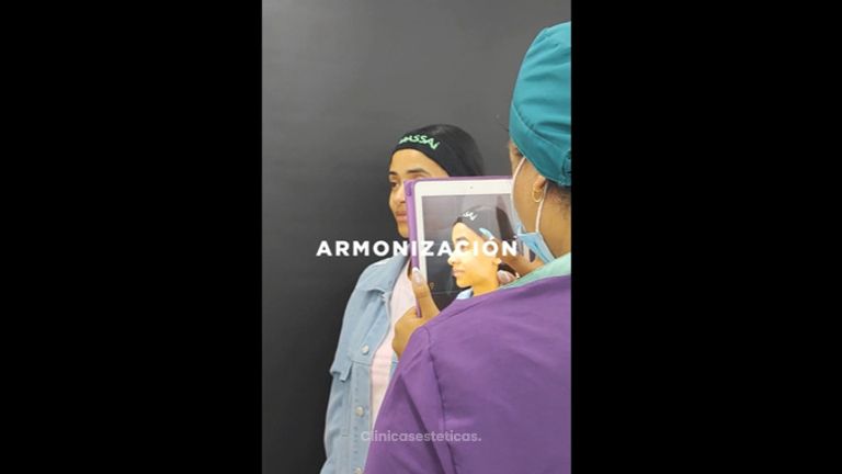 Armonización facial - Massai Clínica