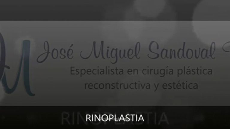 Rinoplastia - Dr. José Miguel Sandoval Rodríguez