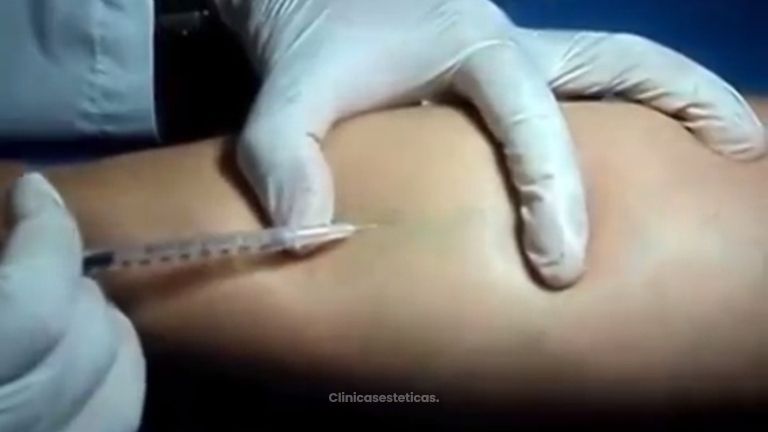 Consigue unas piernas sin problemas venosos