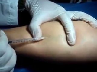 Consigue unas piernas sin problemas venosos