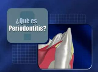 Periodontitis