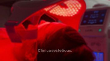 Limpieza Facial Profunda - Dra. Yulieth Figueroa Peñaranda