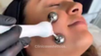 Tratamiento facial para piel joven - Dra. Carmen Padilla