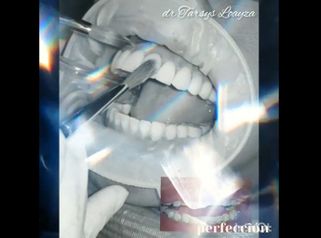 Sonrisa Perfecta Dental - Dra. Tarsys Loayza Roys