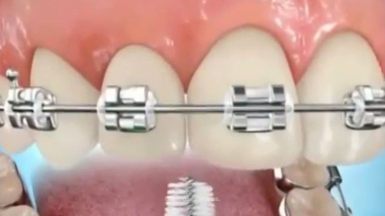 La importancia de la higiene oral en la ortodoncia