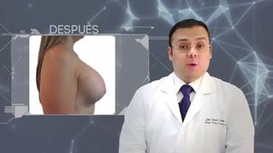 Explicación aumento mamario